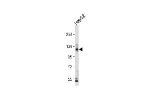 Anti-CEAC Antibody (N-term) at 1:2000 dilution + HepG2 whole cell lysate Lysates/proteins at 20 μg per lane. (CEACAM5 抗体  (N-Term))