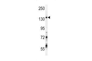 GPRASP1 Antibody (C-term) (ABIN652013 and ABIN2840496) western blot analysis in Jurkat cell line lysates (35 μg/lane). (GPRASP1 抗体  (C-Term))