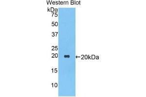 Western Blotting (WB) image for anti-serpin Peptidase Inhibitor, Clade A (Alpha-1 Antiproteinase, Antitrypsin), Member 1 (SERPINA1) (AA 27-181) antibody (ABIN7429058)