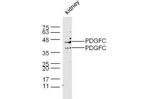 Mouse kidney lysates probed with Rabbit Anti-PDGFC Polyclonal Antibody, Unconjugated  at 1:500 for 90 min at 37˚C. (PDGFC 抗体  (AA 201-300))