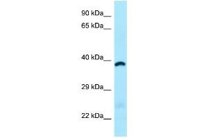 WB Suggested Anti-ABHD6 Antibody Titration: 1. (ABHD6 抗体  (C-Term))