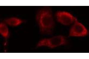 ABIN6274656 staining LOVO cells by IF/ICC. (CYP39A1 抗体  (C-Term))