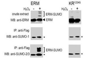 COS-7 cells were transfected for 24 hrs with a plasmid expressing FLAG-ERM (left panels) or FLAG-ERM KR12345 (right panels) . (SUMO1 抗体  (C-Term))
