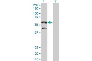 Western Blot analysis of SH2B1 expression in transfected 293T cell line by SH2B1 monoclonal antibody (M01), clone 2B9. (SH2B1 抗体  (AA 327-426))