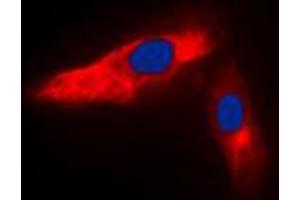 Immunofluorescent analysis of ACTN3 staining in HeLa cells.