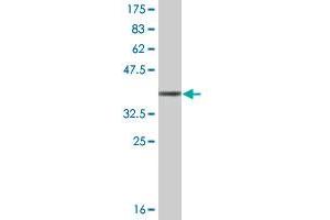 Western Blot detection against Immunogen (36. (TNNT3 抗体  (AA 161-258))