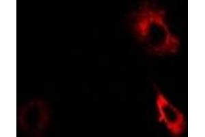 Immunofluorescent analysis of AKR7A2 staining in Hela cells. (AKR7A2 抗体)