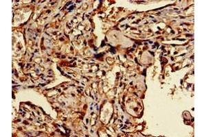 Immunohistochemistry of paraffin-embedded human placenta tissue using ABIN7172536 at dilution of 1:100 (TFEB 抗体  (AA 1-476))