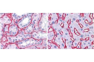 anti collagen IV antibody (600-401-106 Lot 25440, 1:400, 45 min RT) showed strong staining in FFPE sections of human kidney (Left) with strong red staining observed in glomeruli and liver (Right) with strong staining in sinusoids. (Collagen IV 抗体)