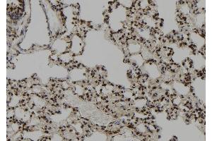 ABIN6260765 and ABIN6273097 at 1/100 staining Rat lung tissue by IHC-P.