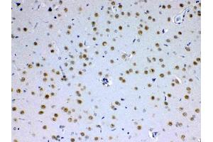 Immunohistochemistry (IHC) image for anti-Mediator Complex Subunit 15 (MED15) (AA 1-285) antibody (ABIN5519035)