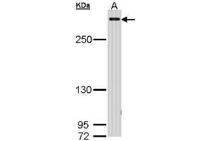 WB Image Sample (30 ug of whole cell lysate) A: H1299 5% SDS PAGE antibody diluted at 1:1000 (CBP 抗体  (C-Term))