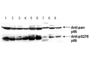 Image no. 4 for anti-Nuclear Factor-kB p65 (NFkBP65) (pSer276) antibody (ABIN1103942) (NF-kB p65 抗体  (pSer276))