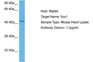 Host: Mouse Target Name: SOX1 Sample Tissue: Mouse Heart Antibody Dilution: 1ug/ml (SOX1 抗体  (Middle Region))