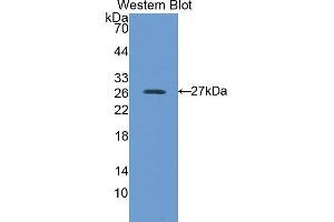 Detection of Recombinant PRDX6, Human using Polyclonal Antibody to Peroxiredoxin 6 (PRDX6) (Peroxiredoxin 6 抗体  (AA 1-224))