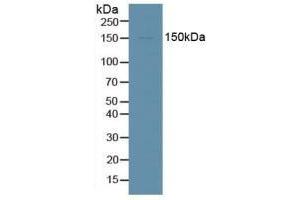 Detection of DDX58 in Human HepG2 Cells using Polyclonal Antibody to Probable ATP-dependent RNA Helicase DDX58 (DDX58) (DDX58 抗体  (AA 1-211))