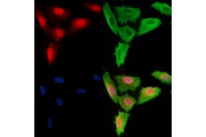 Phospho-SENP2 (Thr368) Antibody staining A549 cells(H2O2 treatment) by IF/ICC.