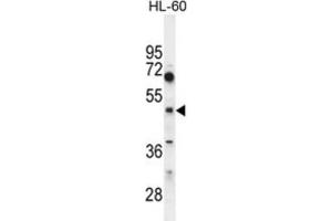 Western Blotting (WB) image for anti-Choline/ethanolamine phosphotransferase 1 (CEPT1) antibody (ABIN2995621) (CEPT1 抗体)