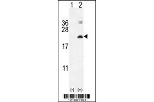Western blot analysis of IL17F using rabbit polyclonal IL17F Antibody using 293 cell lysates (2 ug/lane) either nontransfected (Lane 1) or transiently transfected with the IL17F gene (Lane 2). (IL17F 抗体  (N-Term))