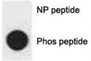 Dot blot analysis of p-p62 antibody.