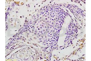 Formalin-fixed and paraffin embedded mouse embryo labeled with Rabbit Anti EphA7/Eph receptor A7 Polyclonal Antibody, Unconjugated (ABIN722005) at 1:200 followed by conjugation to the secondary antibody and DAB staining (EPH Receptor A7 抗体  (AA 181-280))