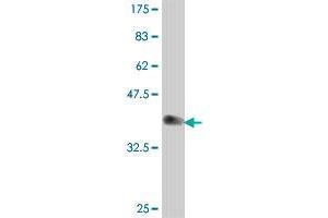 Western Blot detection against Immunogen (37. (UCHL3 抗体  (AA 131-230))