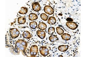 Phospho-HSF1 (Ser326) Antibody at 1/100 staining Rat stomach tissue by IHC-P. (HSF1 抗体  (pSer326))