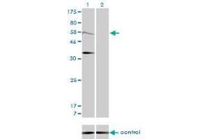 Western blot analysis of MDM2 over-expressed 293 cell line, cotransfected with MDM2 Validated Chimera RNAi (Lane 2) or non-transfected control (Lane 1). (MDM2 抗体  (AA 101-200))