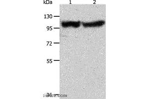 Western blot analysis of Human fetal muscle tissue and hela cell, using ACTN3 Polyclonal Antibody at dilution of 1:400 (ACTN3 抗体)