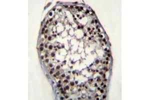Immunohistochemistry analysis in formalin fixed and paraffin embedded human testis tissue reacted with Glycerol kinase Antibody (N-term) followed by peroxidase conjugation of the secondary antibody and DAB staining. (Glycerol Kinase 抗体  (N-Term))
