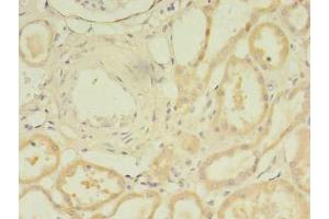 Immunohistochemistry of paraffin-embedded human kidney tissue using ABIN7172078 at dilution of 1:100 (TARS2 抗体  (AA 369-718))