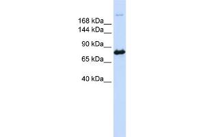 WB Suggested Anti-CAD Antibody Titration:  0. (CAD 抗体  (N-Term))
