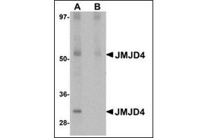 Western blot analysis of JMJD4 in human spleen tissue lysate with this product at 1 μg/ml in (A) the absence and (B) the presence of blocking peptide. (JMJD4 抗体  (N-Term))