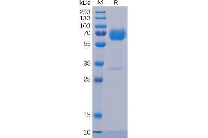 SDS-PAGE (SDS) image for Tumor-Associated Calcium Signal Transducer 2 (TACSTD2) (AA 27-274) protein (mFc-His Tag) (ABIN6961178)
