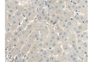 Immunohistochemistry (IHC) image for anti-UDP-Glucose Ceramide Glucosyltransferase (UGCG) (AA 39-171) antibody (ABIN7443101)