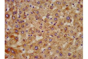 IHC image of ABIN7155981 diluted at 1:300 and staining in paraffin-embedded human liver tissue performed on a Leica BondTM system. (HAO1 抗体  (AA 161-273))