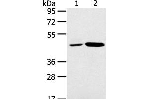 Western Blot analysis of K562 and Jurkat cell using SNX5 Polyclonal Antibody at dilution of 1:250 (SNX5 抗体)