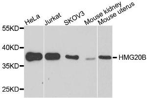 Western blot analysis of extracts of various cell lines, using HMG20B antibody. (HMG20B 抗体  (AA 1-317))
