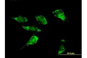 Immunofluorescence of purified MaxPab antibody to PDHA2 on HeLa cell. (PDHA2 抗体  (AA 1-388))