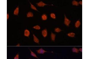 Immunofluorescence analysis of L929 cells using KCNAB2 Polyclonal Antibody at dilution of 1:100.