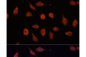 Immunofluorescence analysis of L929 cells using KCNAB2 Polyclonal Antibody at dilution of 1:100. (KCNAB2 抗体)