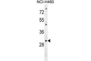 Western Blotting (WB) image for anti-phosphoglycerate Mutase 2 (Muscle) (PGAM2) antibody (ABIN2995678) (PGAM2 抗体)