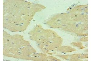 Immunohistochemistry (IHC) image for anti-Myosin Heavy Chain 1, Skeletal Muscle, Adult (MYH1) (AA 1-100) antibody (ABIN7160559)