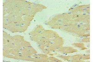 Immunohistochemistry of paraffin-embedded human skeletal muscle tissue using ABIN7160559 at dilution of 1:100 (MYH1 抗体  (AA 1-100))