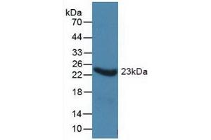 Western blot analysis of recombinant Human a1AGP. (ORM1 抗体  (AA 19-201))