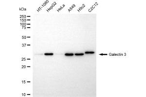 Western blotting analysis using galectin 3 antibody (ABIN7798685).