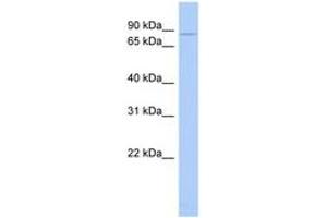 Image no. 1 for anti-Choroideremia (Rab Escort Protein 1) (CHM) (AA 35-84) antibody (ABIN6744369) (CHM 抗体  (AA 35-84))
