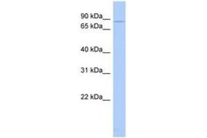 Image no. 1 for anti-Choroideremia (Rab Escort Protein 1) (CHM) (AA 35-84) antibody (ABIN6744369)