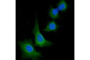 IF analysis of VPS53 using anti-VPS53 antibody (ABIN7599731).