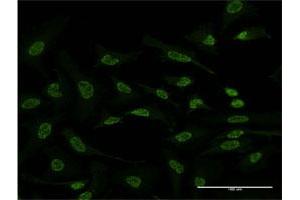 Immunofluorescence (IF) image for anti-Activating Transcription Factor 2 (ATF2) (AA 91-190) antibody (ABIN514584)
